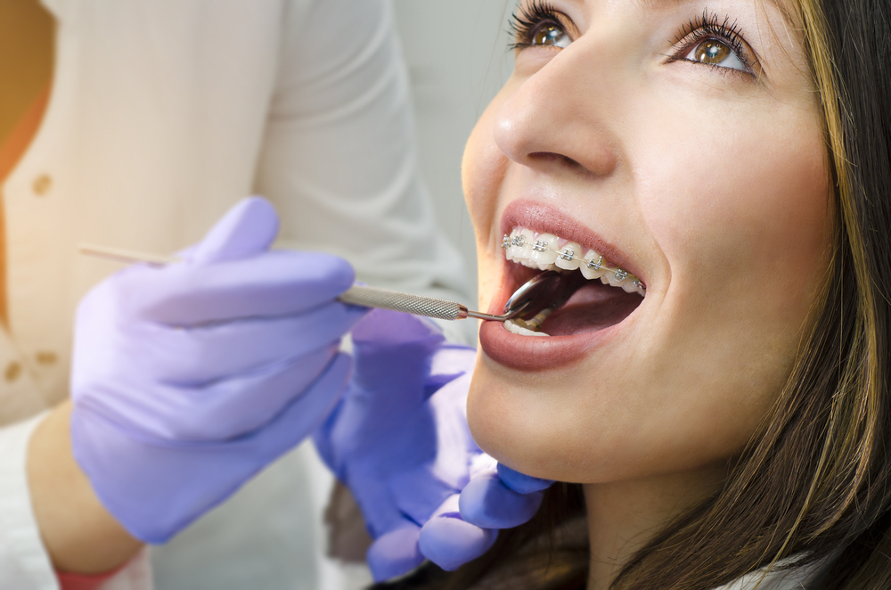 conventional-braces-vs-clear-aligners-which-works-best-for-you