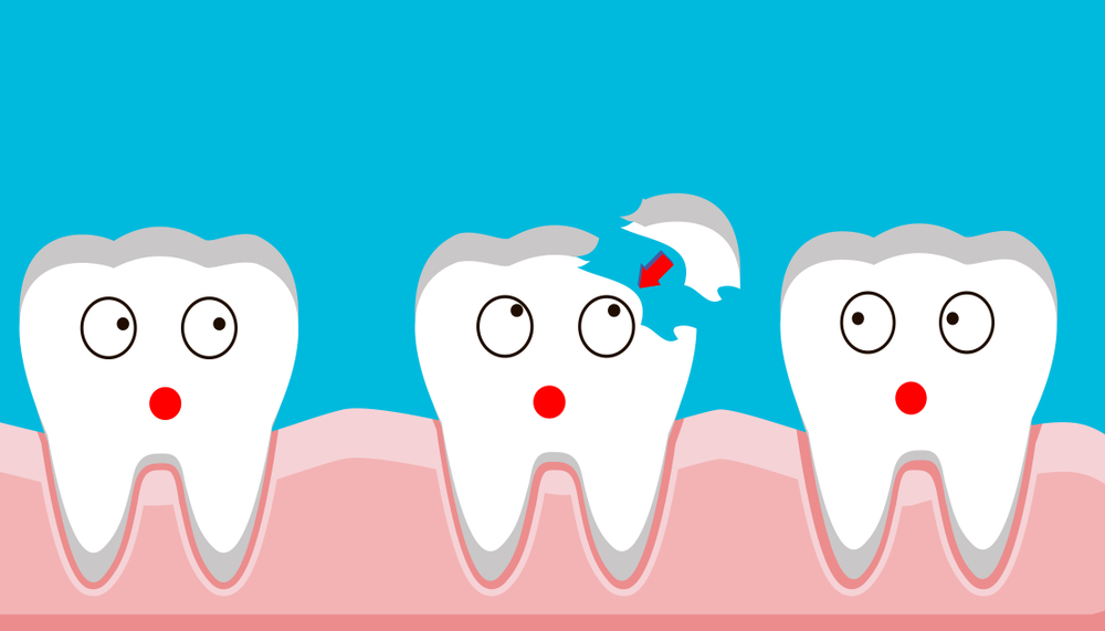 how-to-manage-your-childs-chipped-or-cracked-tooth