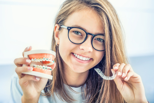 how-to-choose-braces-for-your-teeth-on-devshree-dental-care