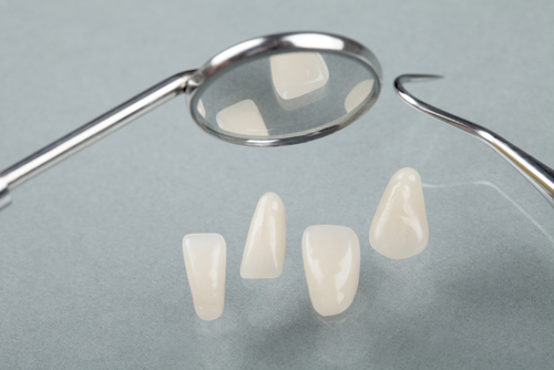 top-4-cases-when-you-can-use-dental-laminates-for-a-beautiful-smile