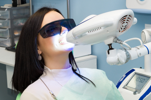faqs-on-laser-teeth-whitening-2021